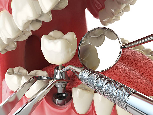 Best Emergency Denture Repair in Indio, CA